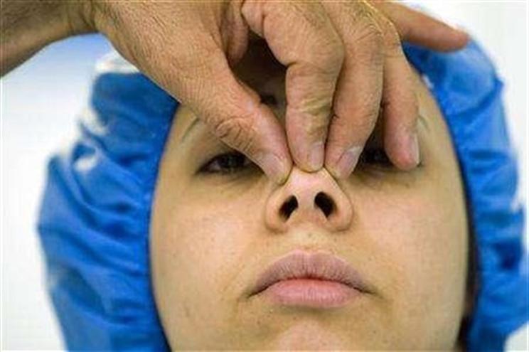  عمل جراحی بینی